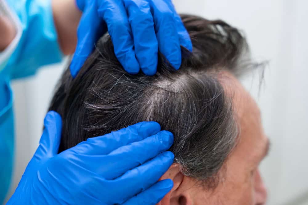 Cosa posso fare per infoltire i capelli